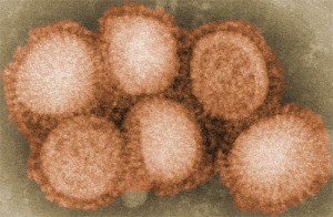 Medicina: Creato Supervirus H5N1, più forte dell’aviaria?